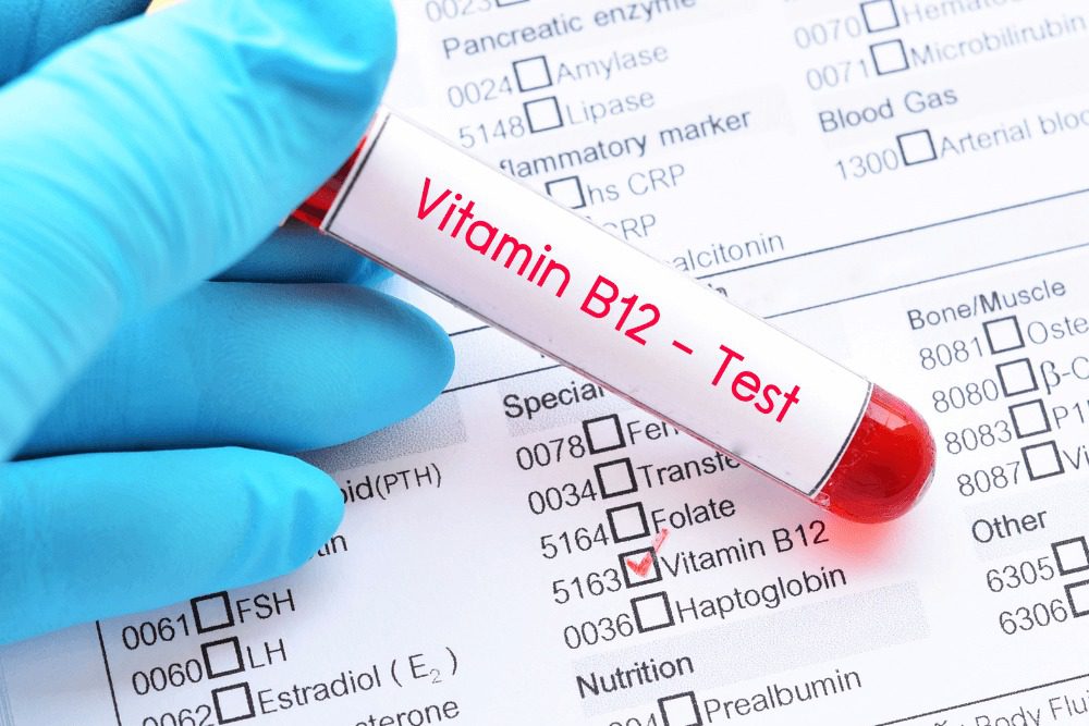 Diagnóstico médico en sangre de vitamina b12