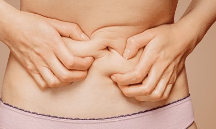 Cómo preparar cremas caseras para la grasa abdominal